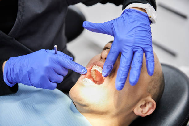 Best Broken or Cracked Tooth Emergency Dentist in Ruston, LA