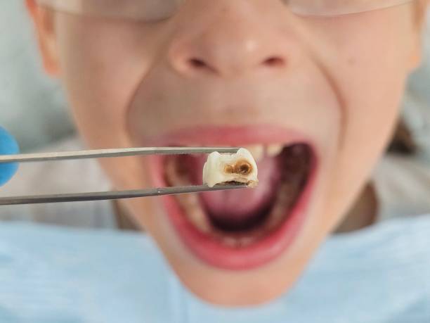 Best Urgent Dental Care for Toothache in Ruston, LA